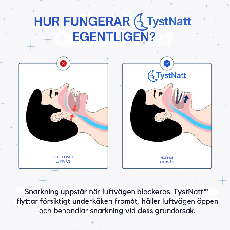 TystNatt™ Pro - BettSkena Mot Snarkningar